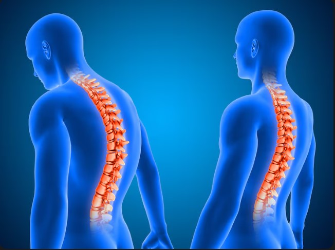 Best Minimally Invasive Spine Surgeon in Mumbai Central 